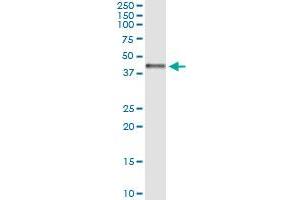 Immunoprecipitation of CTH transfected lysate using anti-CTH MaxPab rabbit polyclonal antibody and Protein A Magnetic Bead , and immunoblotted with CTH purified MaxPab mouse polyclonal antibody (B01P) . (CTH antibody  (AA 1-405))