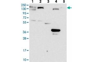 Western blot analysis of Lane 1: RT-4, Lane 2: U-251 MG, Lane 3: Human Plasma, Lane 4: Liver, Lane 5: Tonsil with GOLGA3 polyclonal antibody  at 1:100-1:250 dilution.
