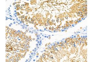 ABIN6257821 and ABIN6275447 at 1/100 staining Rat testis tissue by IHC-P.