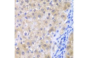 Immunohistochemistry of paraffin-embedded human liver injury using GPX4 antibody (ABIN6294188) at dilution of 1:200 (40x lens). (GPX4 antibody)