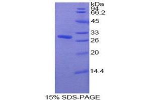 SDS-PAGE (SDS) image for Pyridoxal Kinase (PDXK) (AA 29-253) protein (His tag) (ABIN1879335)