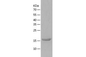 Western Blotting (WB) image for Fc gamma RII (CD32) (AA 34-216) protein (His tag) (ABIN7285336) (Fc gamma RII (CD32) (AA 34-216) protein (His tag))