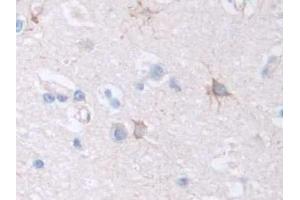 Detection of F8 in Human Cerebrum Tissue using Polyclonal Antibody to Coagulation Factor VIII (F8) (Factor VIII antibody  (AA 1887-2044))