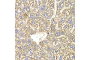 Immunohistochemistry of paraffin-embedded mouse liver using CYP2C18 antibody at dilution of 1:100 (x400 lens).