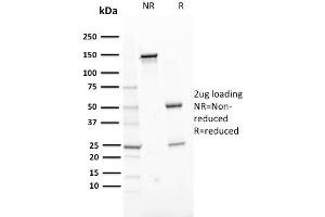 SDS-PAGE Analysis Purified ERCC1 Mouse Monoclonal Antibody (ERCC1/2318). (ERCC1 antibody  (AA 191-281))