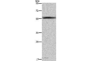 Western blot analysis of Human fetal liver tissue , using FAR2 Polyclonal Antibody at dilution of 1:1000 (FAR2 antibody)