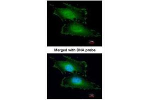 ICC/IF Image Immunofluorescence analysis of paraformaldehyde-fixed HeLa, using Peflin, antibody at 1:200 dilution. (PEF1 antibody)