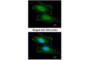 ICC/IF Image Immunofluorescence analysis of paraformaldehyde-fixed HeLa, using Peflin, antibody at 1:200 dilution.