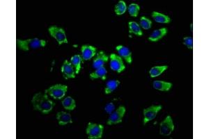 Immunofluorescence staining of A549 cells with ABIN7158393 at 1:66, counter-stained with DAPI. (LSAMP antibody  (AA 168-287))