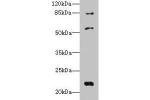Western blot All lanes: PYHIN1 antibody at 6 μg/mL + Mouse small intestine tissue Secondary Goat polyclonal to rabbit IgG at 1/10000 dilution Predicted band size: 56, 55, 52, 51, 27, 26 kDa Observed band size: 56, 22, 84 kDa (PYHIN1 antibody  (AA 1-245))