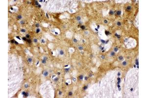 Immunohistochemistry (IHC) image for anti-Syntaxin Binding Protein 1 (STXBP1) (AA 184-216), (N-Term) antibody (ABIN3043413)