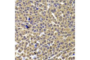 Immunohistochemistry of paraffin-embedded mouse cancer using ARID3A antibody (ABIN5975618) at dilution of 1/100 (40x lens). (ARID3A antibody)