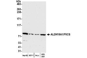 Western Blotting (WB) image for anti-Aldehyde Dehydrogenase 18 Family, Member A1 (ALDH18A1) (AA 575-625) antibody (ABIN7449868)