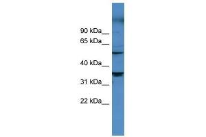 CYP11B1 antibody used at 0.