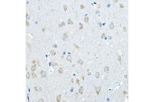 Immunohistochemistry of paraffin-embedded rat brain using IDS Rabbit pAb (ABIN3015633, ABIN3015634, ABIN3015635 and ABIN6218988) at dilution of 1:200 (40x lens). (IDS antibody  (AA 34-290))