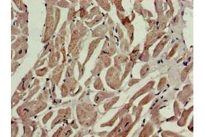 IHC analysis of paraffin-embedded human heart tissue, using P4HA1 antibody (1/100 dilution). (P4HA1 antibody  (AA 256-525))