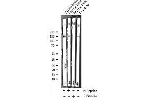 TRKB antibody  (pTyr706)