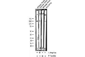 Western blot analysis of Phospho-Trk B (Tyr705) expression in various lysates