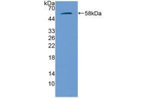 Western blot analysis of recombinant Mouse GbA. (GBA antibody  (AA 255-509))