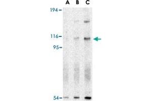 Western blot analysis of ERN1 in A-20 cell lysate with ERN1 polyclonal antibody  at (A) 0. (ERN1 antibody  (N-Term))