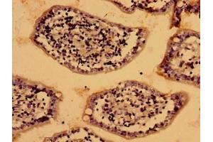 Immunohistochemistry of paraffin-embedded human small intestine tissue using ABIN7158451 at dilution of 1:100 (LIAS antibody  (AA 28-372))