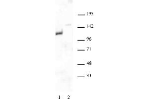 Androgen Receptor antibody (pAb) tested by Western blot. (Androgen Receptor antibody  (N-Term))