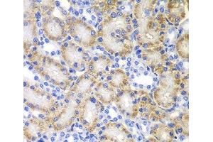 Immunohistochemistry of paraffin-embedded Rat kidney using RARB Polyclonal Antibody at dilution of 1:100 (40x lens). (Retinoic Acid Receptor beta antibody)