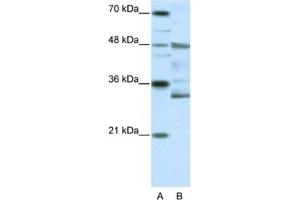 Western Blotting (WB) image for anti-Forkhead Box N2 (FOXN2) antibody (ABIN2461648) (FOXN2 antibody)