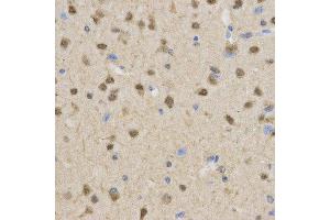 Immunohistochemistry (IHC) image for anti-Transducin-Like Enhancer of Split 1 (E(sp1) Homolog, Drosophila) (TLE1) antibody (ABIN1876687) (TLE1 antibody)