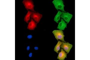 ABIN7094990 and ABIN7099046 staining  cells by IF/ICC.