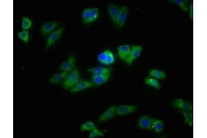 Immunofluorescence staining of HepG2 cells with ABIN7170398 at 1:213, counter-stained with DAPI. (SNX5 antibody  (AA 7-245))