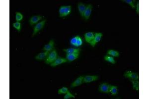 Immunofluorescence staining of HepG2 cells with ABIN7170398 at 1:213, counter-stained with DAPI.