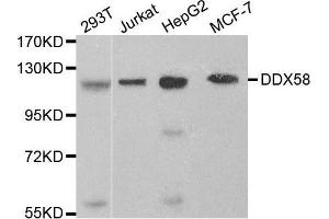 Western blot analysis of extracts of various cell lines, using DDX58 antibody. (DDX58 antibody  (C-Term))