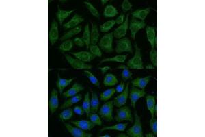 Immunofluorescence analysis of L929 cells using R Polyclonal Antibody (ABIN7269849) at dilution of 1:100 (40x lens). (GRF2 antibody  (AA 844-1095))
