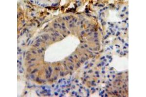 Used in DAB staining on fromalin fixed paraffin-embedded Lung tissue (IL-18 antibody  (AA 36-192))