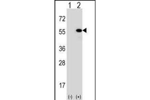 Western blot analysis of DNAJA1 (arrow) using rabbit polyclonal DNAJA1 Antibody (Center) (ABIN652030 and ABIN2840506). (DNAJA1 antibody  (AA 294-323))