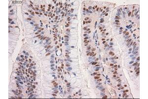 Image no. 3 for anti-Myc Proto-Oncogene protein (MYC) antibody (ABIN1497013) (c-MYC antibody)