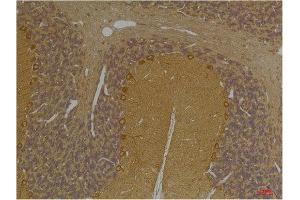Immunohistochemistry (IHC) analysis of paraffin-embedded Rat Brain Tissue using SLC12A4 Rabbit Polyclonal Antibody diluted at 1:200. (SLC12A4 antibody)