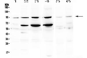 Western blot analysis of STAT1 using anti- STAT1 antibody . (STAT1 antibody  (Middle Region))
