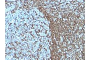 Immunohistochemical staining (Formalin-fixed paraffin-embedded sections) of human tonsil with ICAM3 monoclonal antibody, clone ICAM3/1019 .