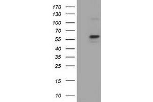 Western Blotting (WB) image for anti-Pyruvate Kinase, Liver and RBC (PKLR) antibody (ABIN1500248) (PKLR antibody)