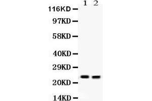 Lipocalin 2 antibody  (AA 21-198)