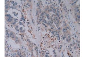 Immunohistochemistry (IHC) image for anti-Granzyme B (GZMB) (AA 21-247) antibody (ABIN7432145)