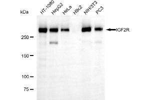 Western blotting analysis using IGF2R antibody (ABIN7799053).