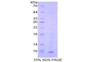 SDS-PAGE (SDS) image for Chemokine (C-C Motif) Ligand 22 (CCL22) (AA 29-92) protein (His tag) (ABIN2121578)