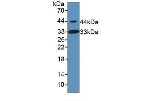 Detection of INHbB in Rat Serum using Polyclonal Antibody to Inhibin Beta B (INHbB) (INHBB antibody  (AA 297-411))