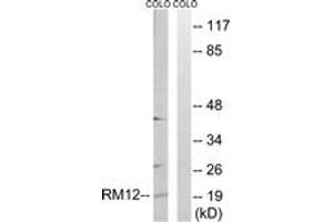 Western blot analysis of extracts from COLO cells, using MRPL12 Antibody.