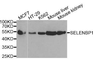 Western blot analysis of extracts of various cells, using SELENBP1 antibody. (SELENBP1 antibody)