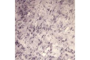 IHC on rat brain using Rabbit antibody to extracellular, N-terminal part of Sortilin (Neurotensin receptor 3, NTR3, Sort1): IgG  at a concentration of 10 µg/ml. (Sortilin 1 antibody)