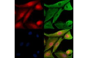 Phospho-TAO2 (Ser181) Antibody staining A549 cells(H2O2 treatment) by IF/ICC.